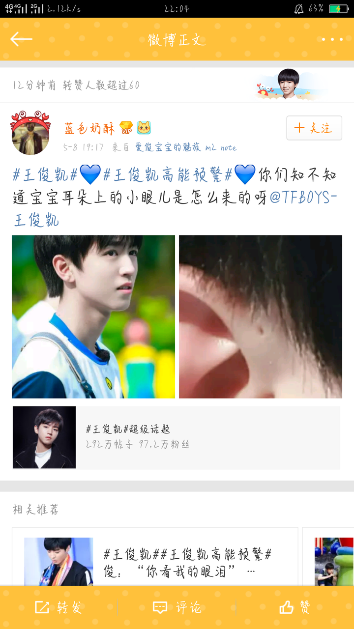 tfboys分享170509王俊凯右耳上有个小洞原来是患有先天性耳前瘘管